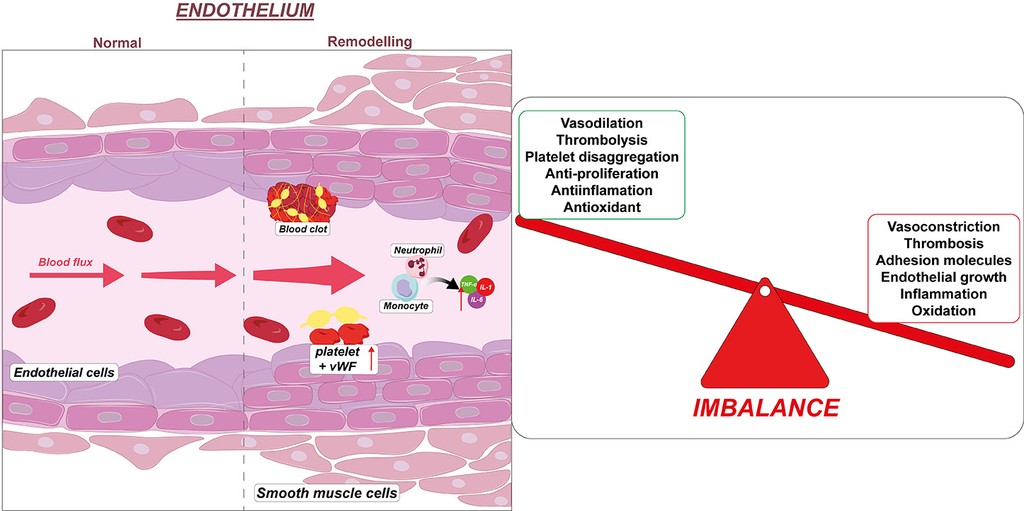 Plain language summary preview